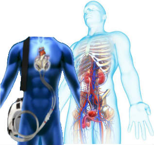 artificial-organs-market