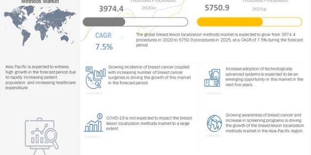 Breast Lesion Localization Methods Market