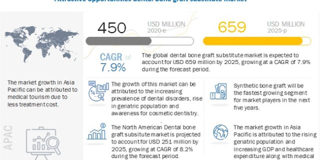 Dental Bone Graft Substitute Market